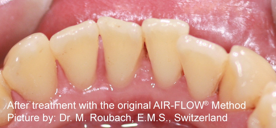 aft-polisher-img