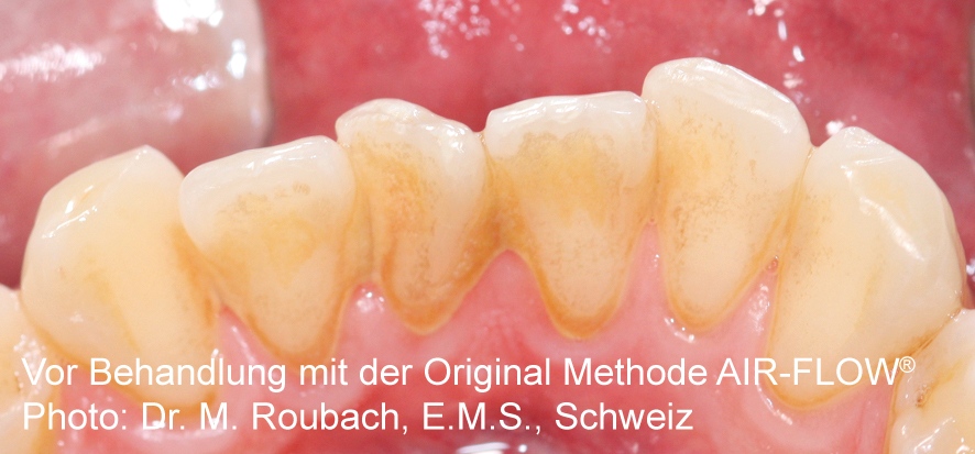 bef-polisher-2-img